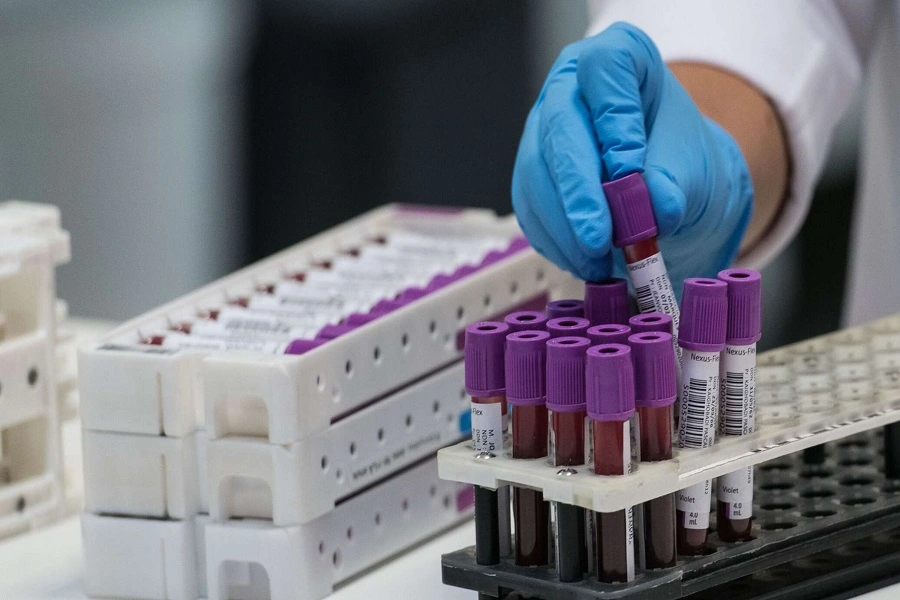 kolay-sonuc-veren-sma-test-fiyati