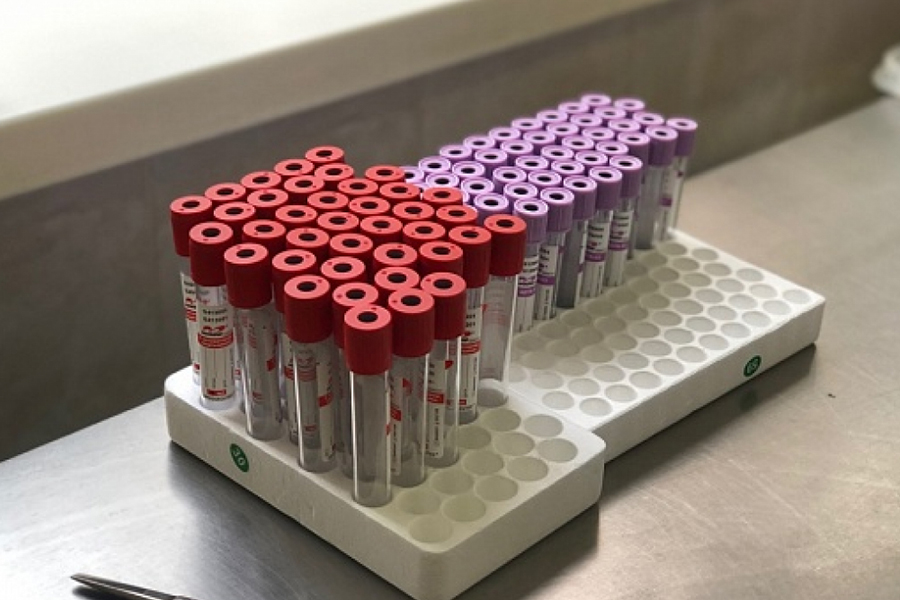 sma-tasiyici-testi-2022-yili-ucreti