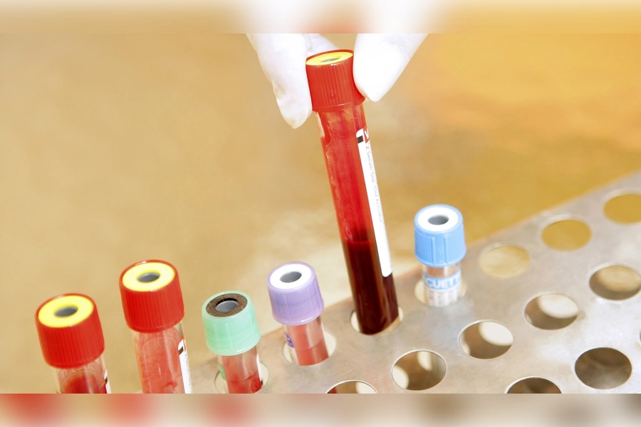 sma-testi-ücreti