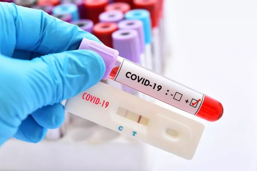 evde-pcr-testi-istanbul
