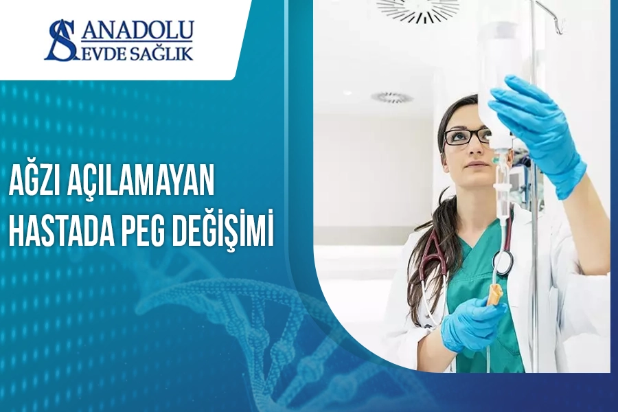 Ağzı Açılamayan Hastada PEG Değişimi