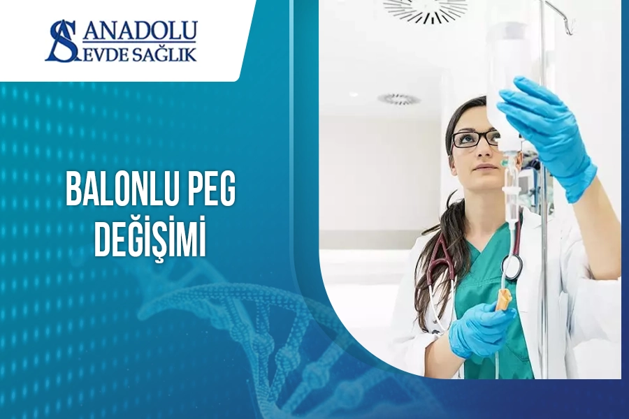 Balonlu Peg Değişimi