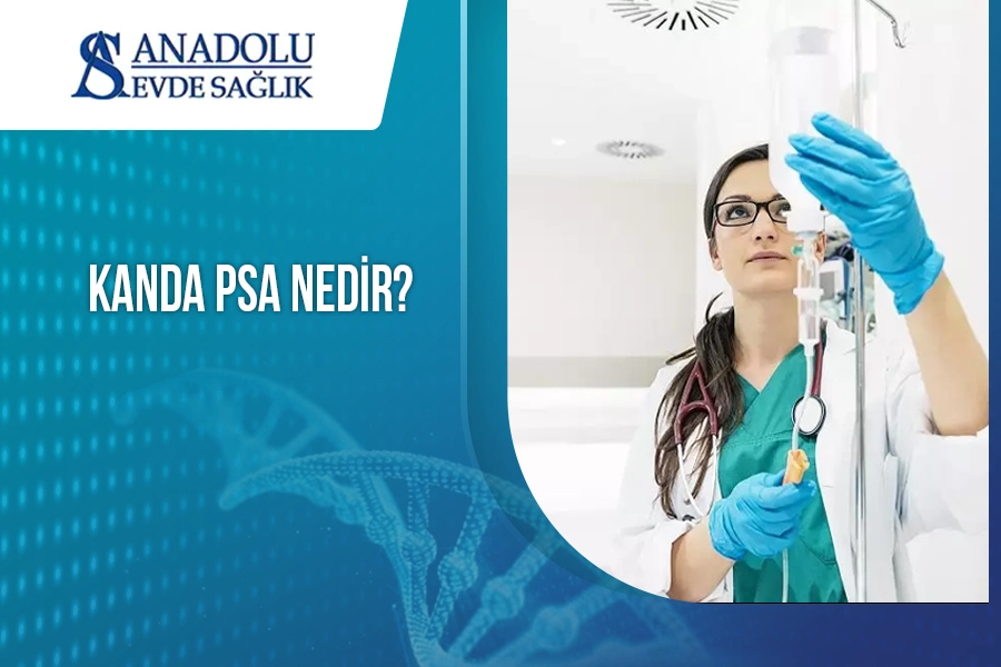 Kanda PSA Nedir?