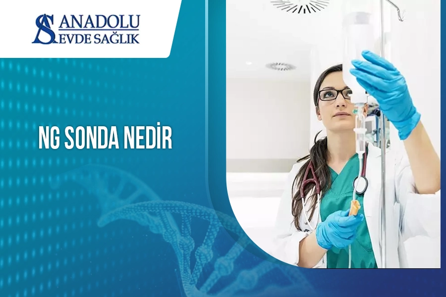 NG Sonda Nedir?